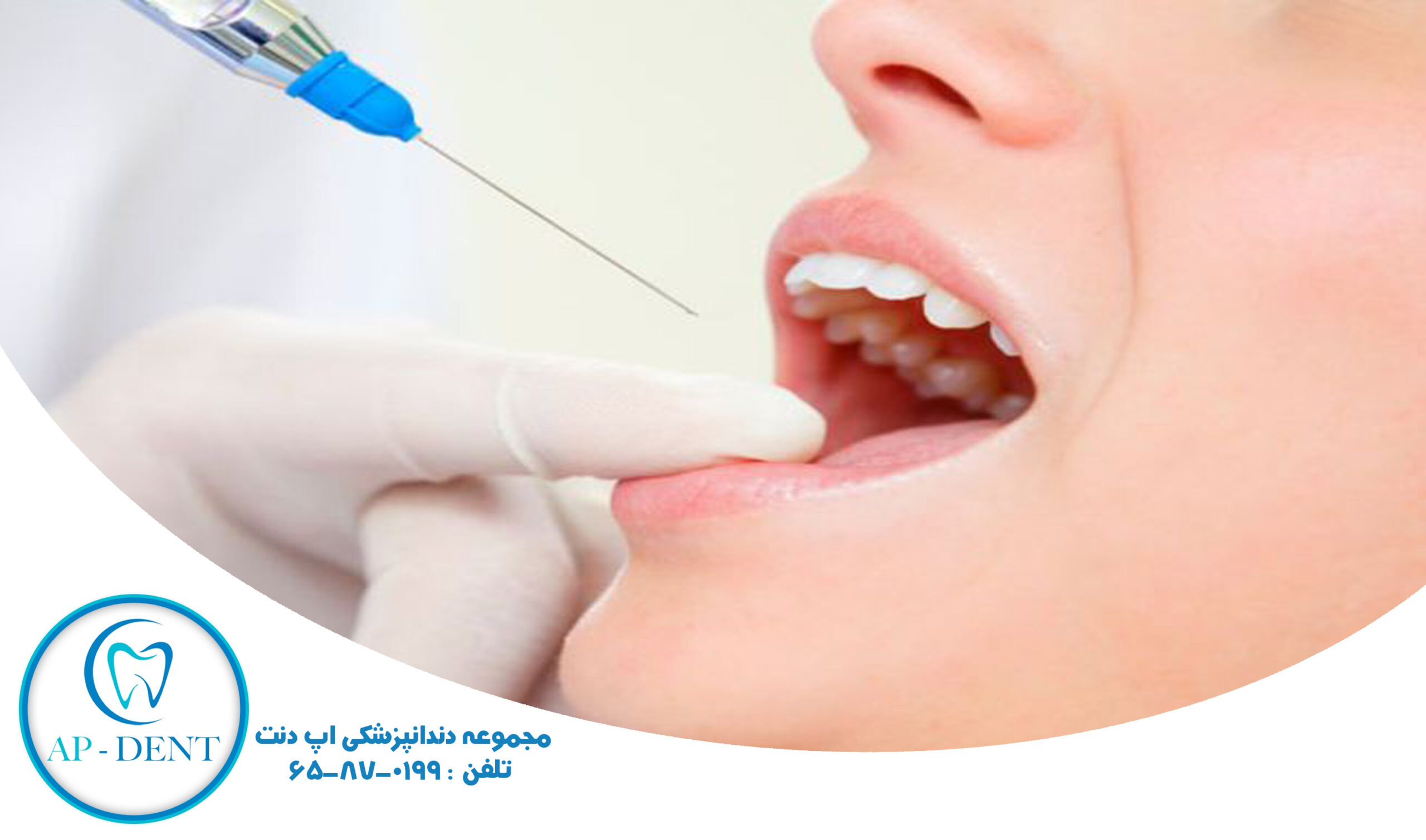 چطور سرسوزن دندانپزشکی را بشناسیم ؟